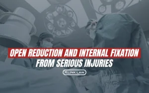 Open Reduction and Internal Fixation From Serious Injuries